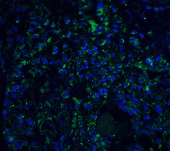 STAT1 Antibody