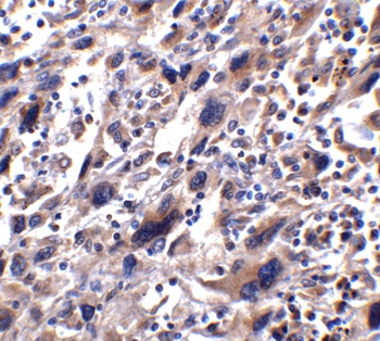 STAT1 alpha Antibody