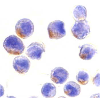 STAT1 Antibody