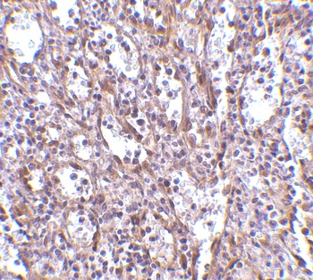 STIM1 Antibody