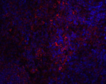STIM1 Antibody