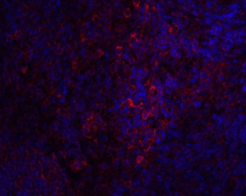 STIM1 Antibody