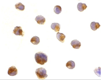 CASP6 Antibody