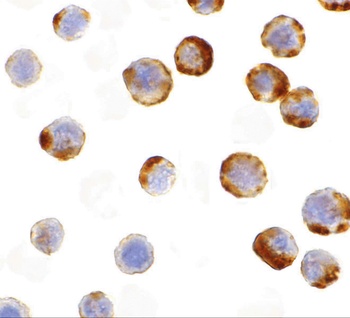 CASP6 Antibody