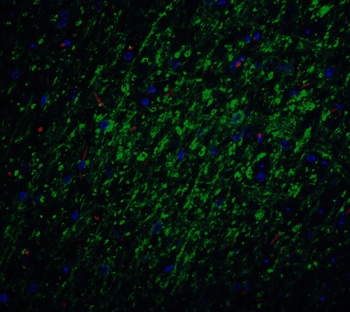 BIRC5 Antibody