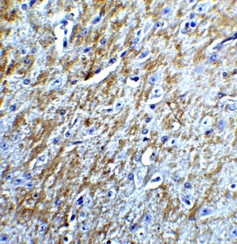 BIRC5 Antibody