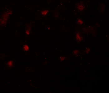 CASK Antibody