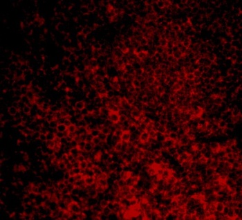 CARMA1 Antibody