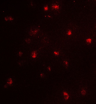 CARM1 Antibody