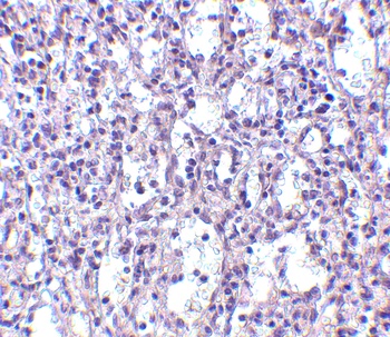 Carabin Antibody