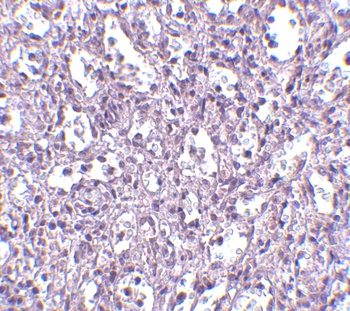 Carabin Antibody