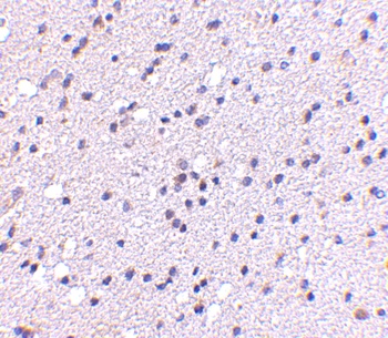 CAPS2 Antibody