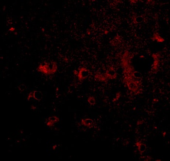 CAPS2 Antibody