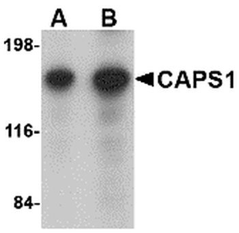 CADPS Antibody
