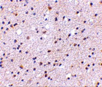 CADPS Antibody