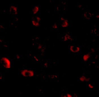 CAPS1 Antibody