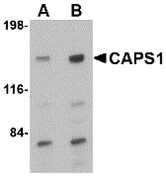 CADPS Antibody