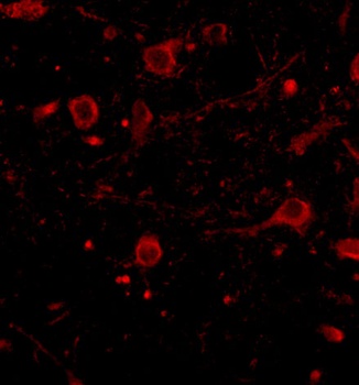 CADPS Antibody