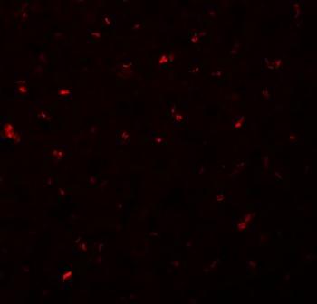 CALHM1 Antibody