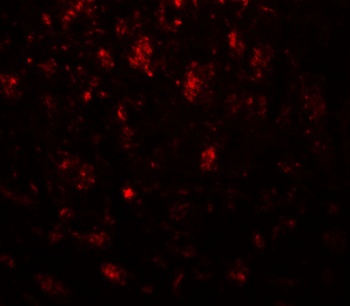 CADM3 Antibody