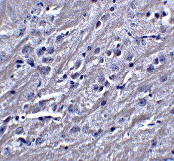 SYNPO Antibody