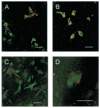 ADAM17 Antibody