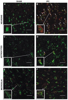TACE Antibody
