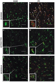 ADAM17 Antibody