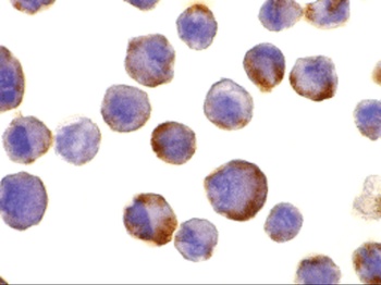 TACE Antibody