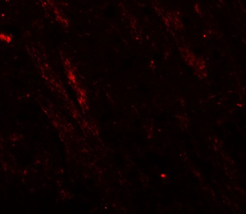CACNA1H Antibody
