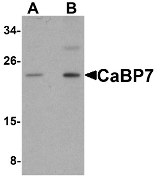 CaBP7 Antibody