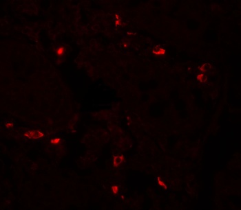 BTLA Antibody