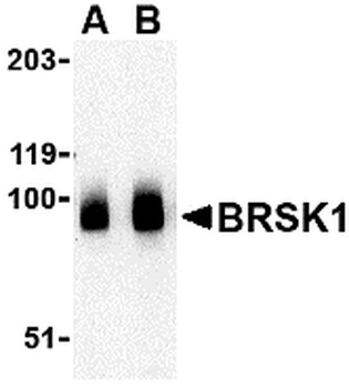 BRSK1 Antibody