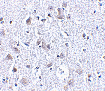 BRSK1 Antibody