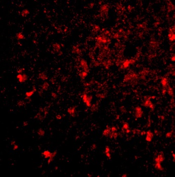 BRCC45 Antibody