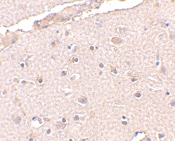 BRCC36 Antibody