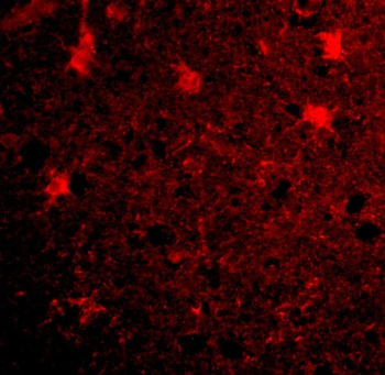 BRCC36 Antibody