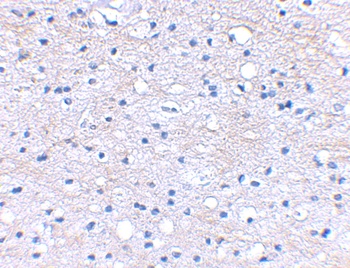 BRAL1 Antibody