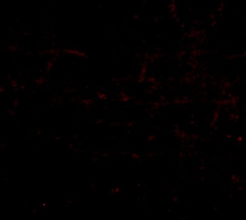 BRAL1 Antibody