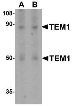 TEM1 Antibody
