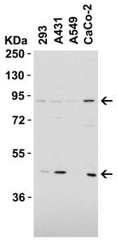 TEM1 Antibody