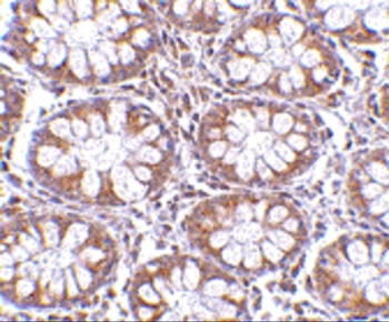 CD248 Antibody