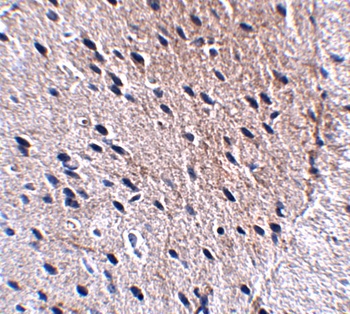 Bora Antibody