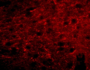 Bora Antibody