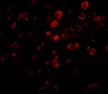 Bora Antibody