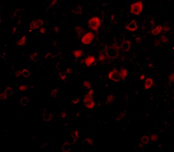 BORA Antibody