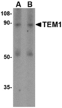 TEM1 Antibody