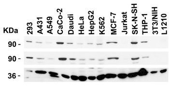 TEM1 Antibody