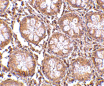 CD248 Antibody