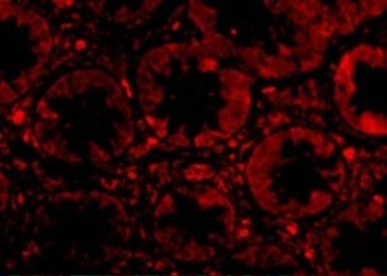 TEM1 Antibody